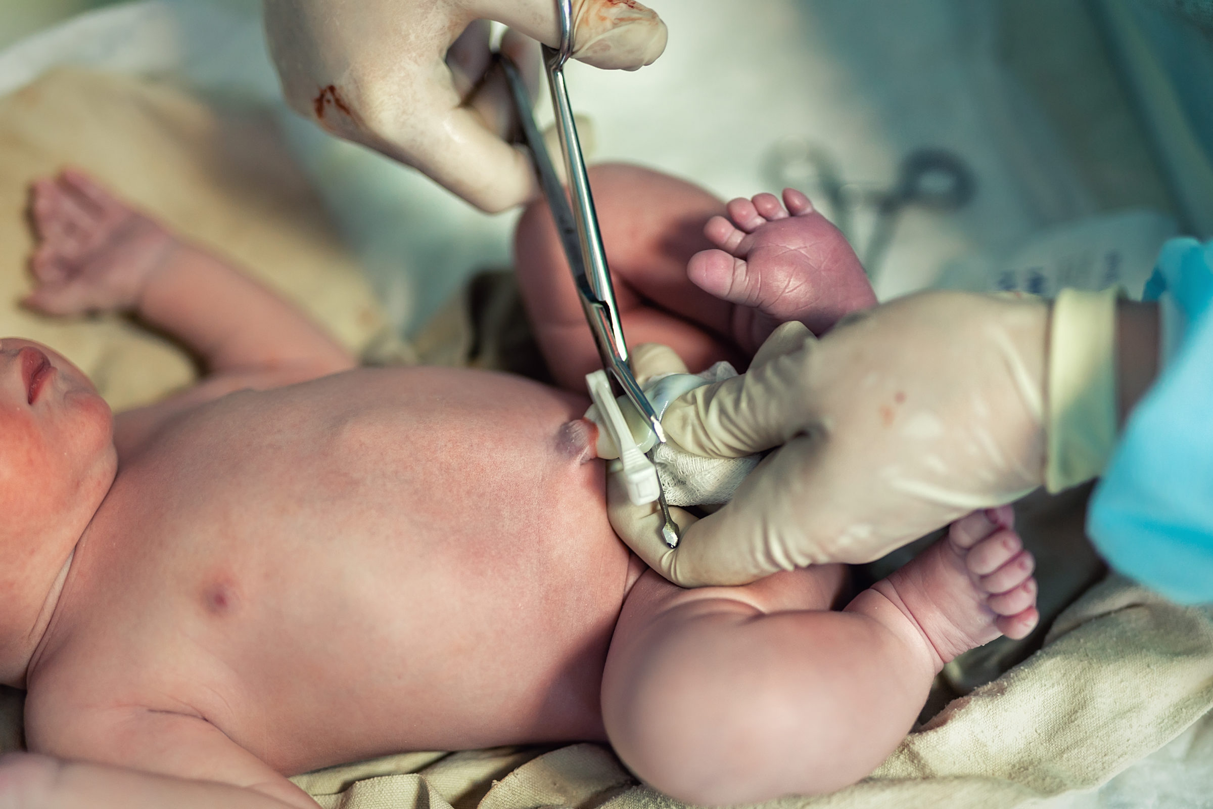 Close-up doctor obstetrician nurse cutting umbilical cord with medical scissors to newborn infant baby. Medical surgeon giving birth to child. New human life begin. delivery labor childbirth hospital